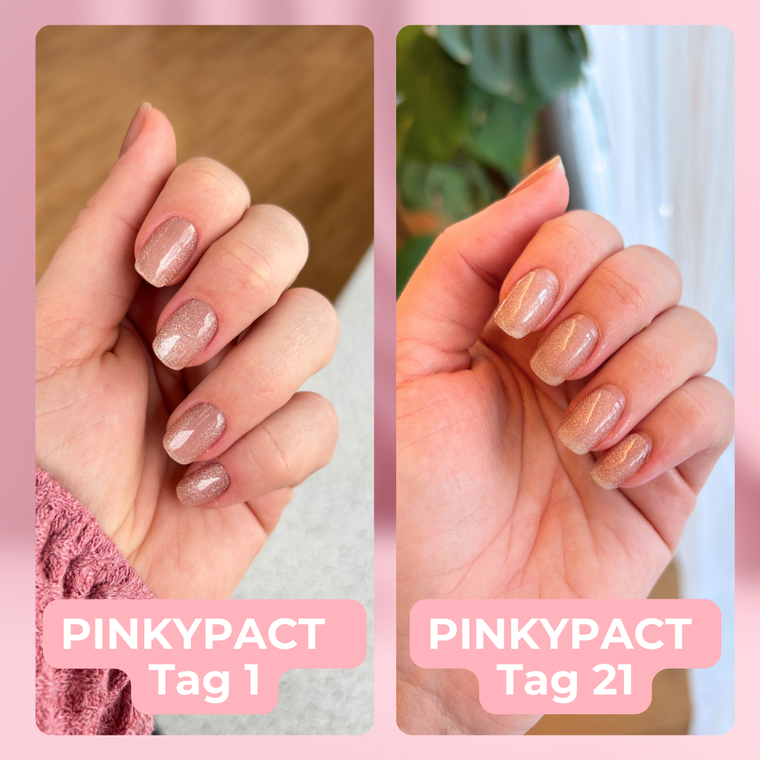 Sunset Sparkle